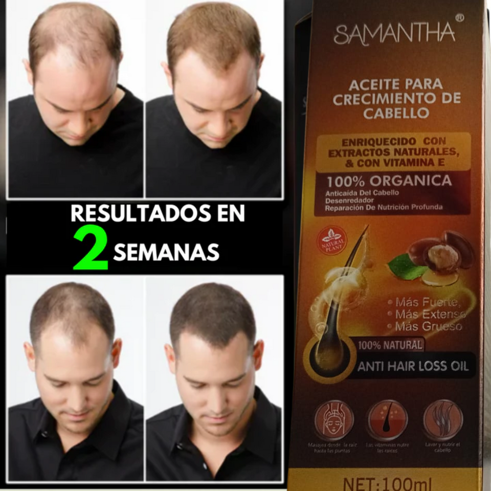 NUEVO ACEITE PARA EL CRECIMIENTO DEL CABELLO